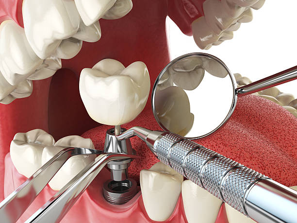 Best Emergency Dental Services Near Me  in Cabin John, MD